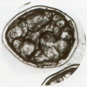 餡（豆類）の顕微鏡写真表面の膜が蛋白質や繊維でできた細胞膜